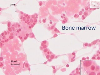 Comprehensive Overview of Hematopoiesis: Erythropoiesis and ...