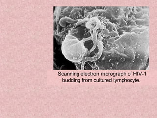 Scanning electron micrograph of HIV-1 budding from cultured lymphocyte.  