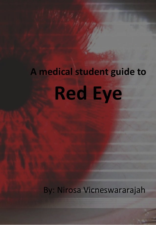 A medical student guide to Red Eye