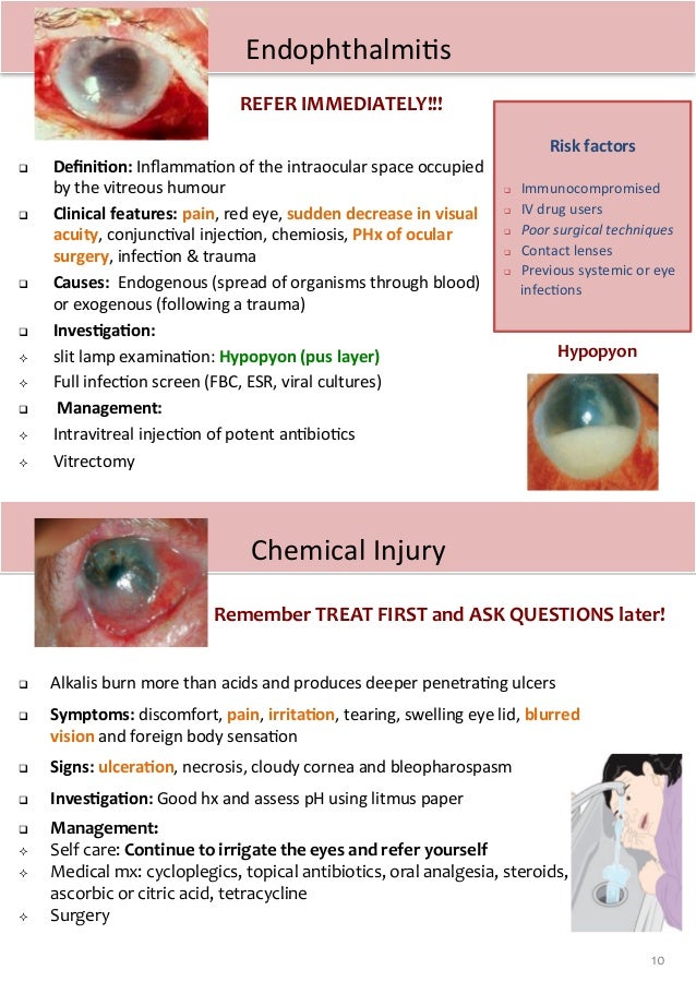 A medical student guide to Red Eye