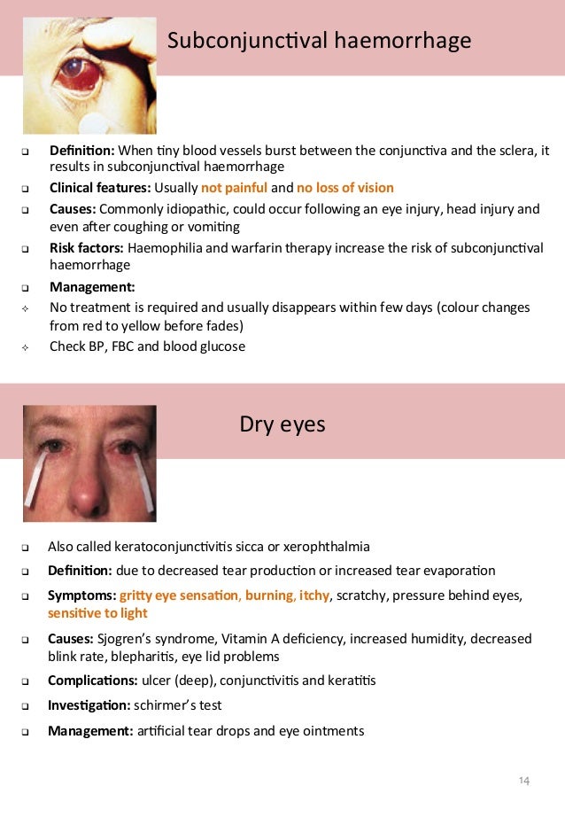 A medical student guide to Red Eye