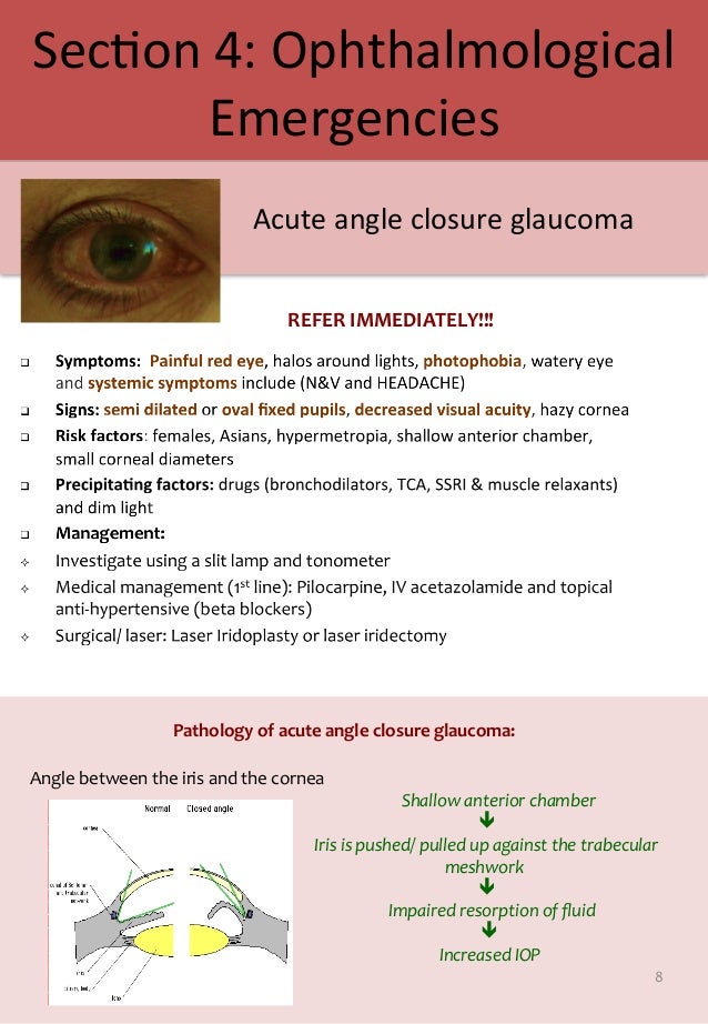 A medical student guide to Red Eye