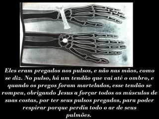 Eles eram pregados nos pulsos, e não nas mãos, como
 se diz. No pulso, há um tendão que vai até o ombro, e
  quando os pregos foram martelados, esse tendão se
rompeu, obrigando Jesus a forçar todos os músculos de
 suas costas, por ter seus pulsos pregados, para poder
        respirar porque perdía todo o ar de seus
                        pulmões.
 