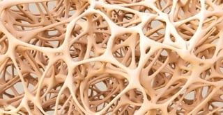 A Guide to Osteoporosis – How to Prevent Bone loss? 