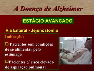 Via Enteral - Jejunostomia A Doença de Alzheimer ESTÁGIO AVANCADO Indicação: Pacientes sem condições de se alimentar pelo estômago Pacientes c/ risco elevado de aspiração pulmonar 