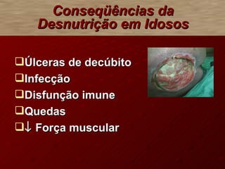 Úlceras de decúbito Infecção Disfunção imune  Quedas    Força muscular Conseqüências da Desnutrição em Idosos 