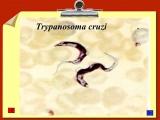 Trypanosoma cruzi 