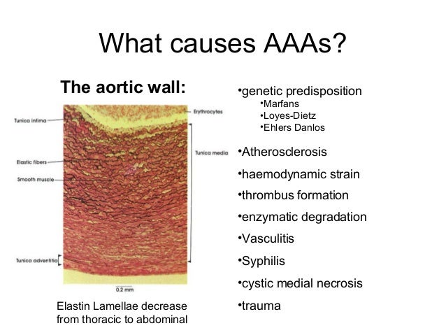 types of aneurysms