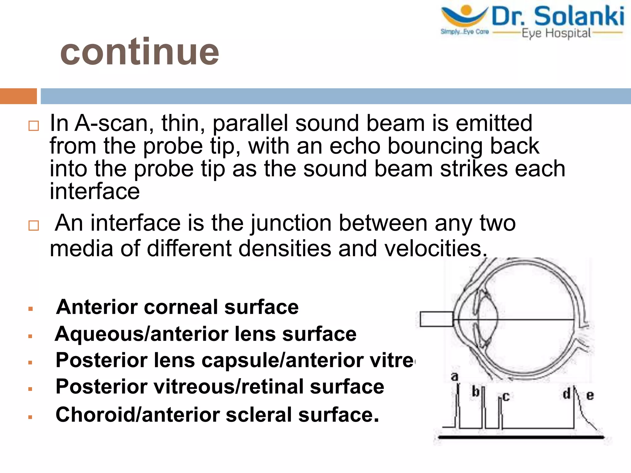 continue
 In A-scan, thin, parallel sound beam is emitted
from the probe tip, with an echo bouncing back
into the probe tip as the sound beam strikes each
interface
 An interface is the junction between any two
media of different densities and velocities.
 Anterior corneal surface
 Aqueous/anterior lens surface
 Posterior lens capsule/anterior vitreous
 Posterior vitreous/retinal surface
 Choroid/anterior scleral surface.
 