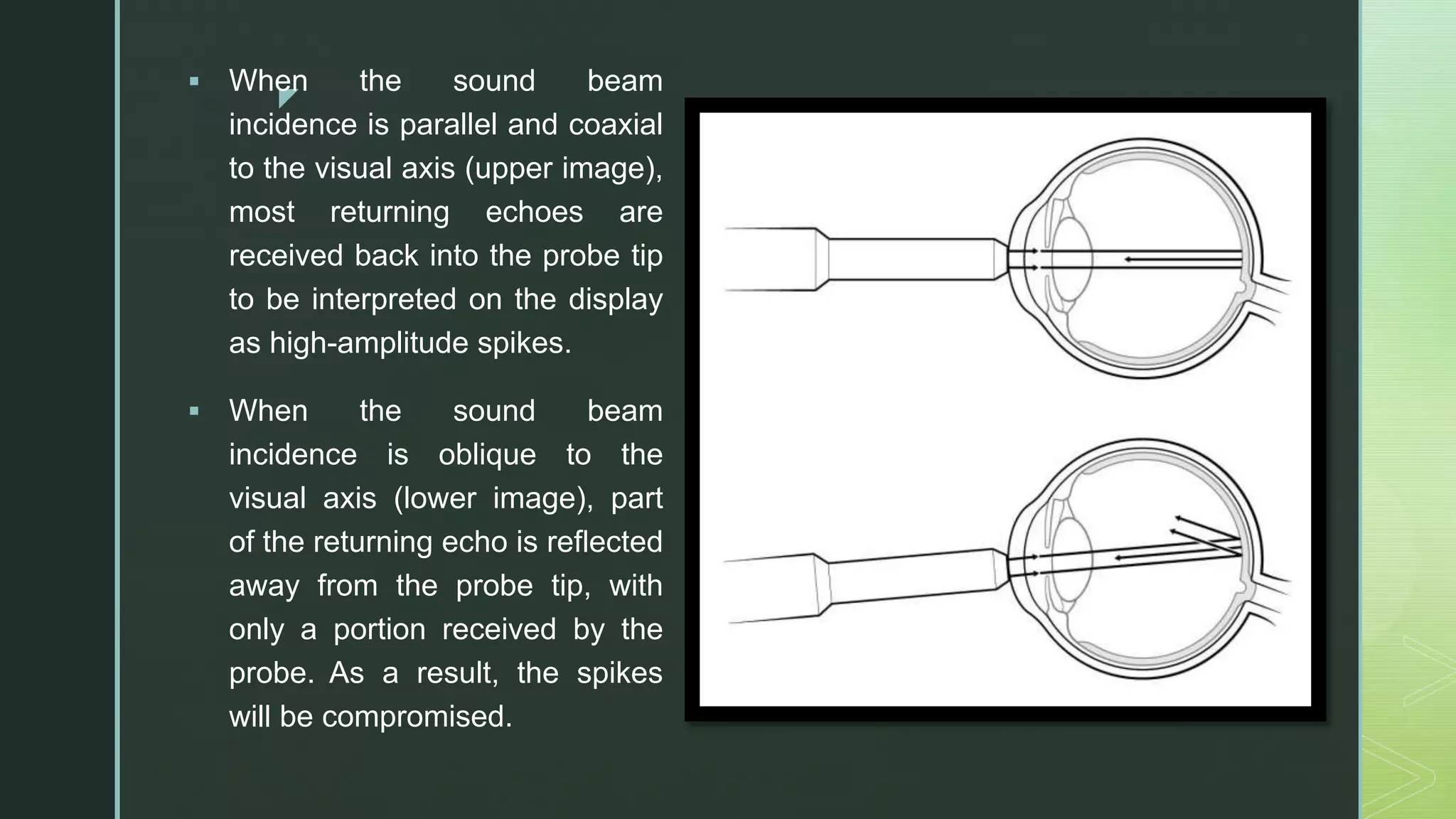 z
 When the sound beam
incidence is parallel and coaxial
to the visual axis (upper image),
most returning echoes are
received back into the probe tip
to be interpreted on the display
as high-amplitude spikes.
 When the sound beam
incidence is oblique to the
visual axis (lower image), part
of the returning echo is reflected
away from the probe tip, with
only a portion received by the
probe. As a result, the spikes
will be compromised.
 
