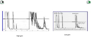 A-Scan Biometry.pptx