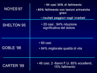 CARTER ‘99 46 casi, 2 -6anni F.U. 85% eccellenti, 15% fallimento GOBLE ‘98 60 casi  84% migliorate qualità di vita NOYES‘97 94 casi 30% di fallimento 80% fallimento con lesioni artrosiche gravi risultati peggiori negli irradiati SHELTON 95 20 casi , 94% riduzione significativa del dolore 