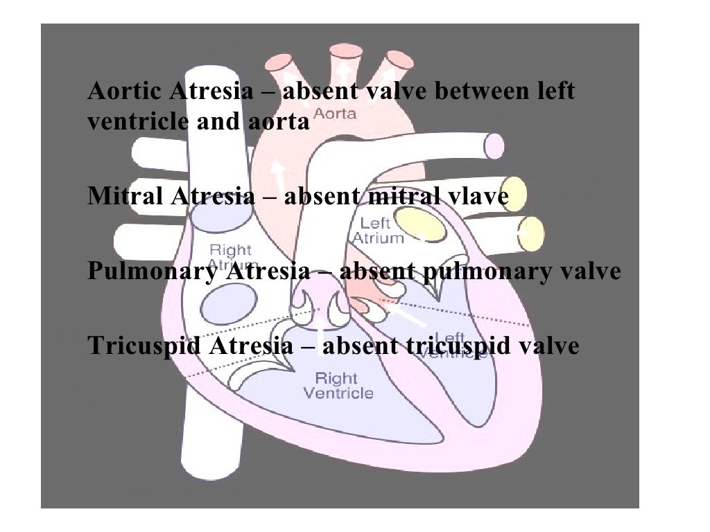 Aortic Atresia absent valve
