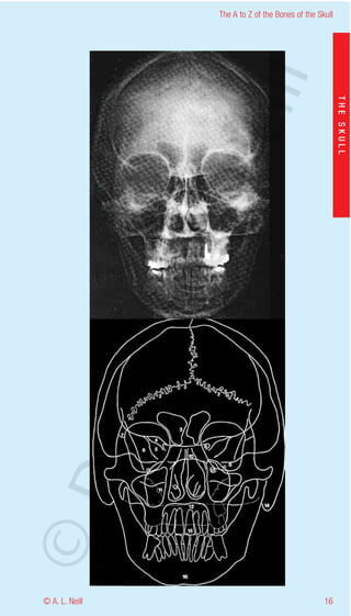 The A to Z of the Bones of the Skull




                    eill
                                                           THE SKULL
                  aN
                   nd
                ma
       rA
©D




© A. L. Neill                                        16
 