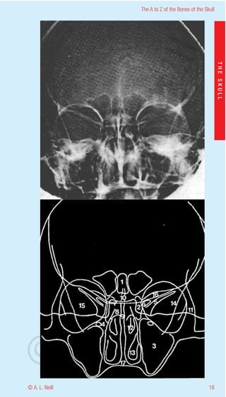 The A to Z of the Bones of the Skull




                    eill
                                                           THE SKULL
                  aN
                   nd
                ma
       rA
©D




© A. L. Neill                                        18
 