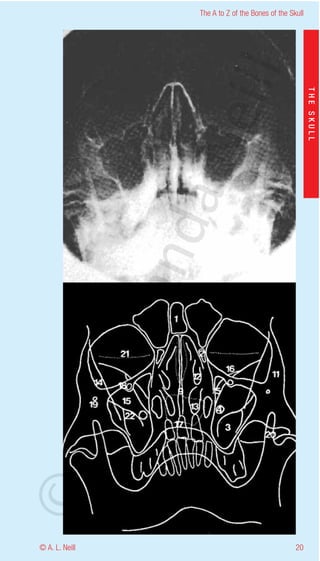 The A to Z of the Bones of the Skull




                    eill
                                                           THE SKULL
                  aN
                   nd
                ma
       rA
©D




© A. L. Neill                                        20
 