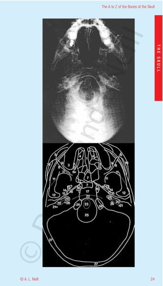 The A to Z of the Bones of the Skull




                    eill
                                                           THE SKULL
                  aN
                   nd
                ma
       rA
©D




© A. L. Neill                                        24
 