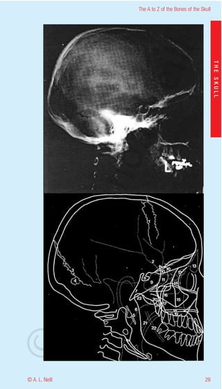 The A to Z of the Bones of the Skull




                    eill
                                                           THE SKULL
                  aN
                   nd
                ma
       rA
©D




© A. L. Neill                                        28
 