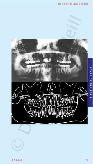 The A to Z of the Bones of the Skull




                    eill
                  aN
                   nd

                                                           BONES OF THE SKULL
                ma
       rA
©D




© A. L. Neill                                        46
 