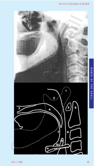 The A to Z of the Bones of the Skull




                    eill
                  aN
                   nd

                                                           BONES OF THE SKULL
                ma
       rA
©D




© A. L. Neill                                        48
 