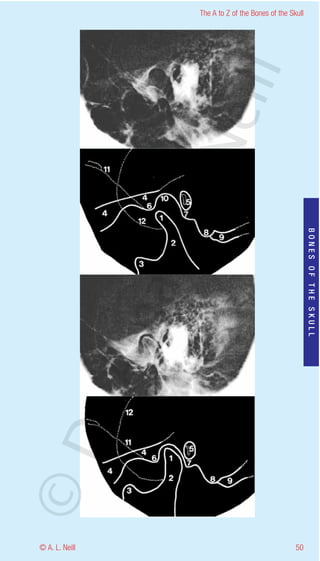 The A to Z of the Bones of the Skull




                    eill
                  aN
                   nd

                                                           BONES OF THE SKULL
                ma
       rA
©D




© A. L. Neill                                        50
 