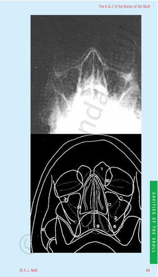 The A to Z of the Bones of the Skull




                    eill
                  aN
                   nd
                ma
       rA


                                                           CAVITIES OF THE SKULL
©D




© A. L. Neill                                        86
 