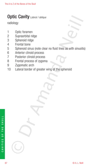 The A to Z of the Bones of the Skull




                             Optic Cavity Lateral / oblique




                                                                        eill
                             radiology

                             1      Optic foramen
                             2      Supraorbital ridge
                             3      Sphenoid ridge




                                                               aN
                             4      Frontal bone
                             5      Sphenoid sinus (note clear no fluid lines as with sinusitis)
                             6      Anterior clinoid process
                             7      Posterior clinoid process
                             8      Frontal process of zygoma
                             9      Zygomatic arch
                                                     nd
                             10     Lateral border of greater wing of the sphenoid
                                                  ma
                                       rA
CAVITIES OF THE SKULL




                        ©D




                        87                                                           © A. L. Neill
 