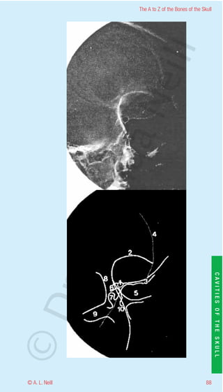 The A to Z of the Bones of the Skull




                    eill
                  aN
                   nd
                ma
       rA


                                                           CAVITIES OF THE SKULL
©D




© A. L. Neill                                        88
 