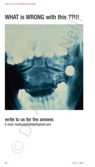 The A to Z of the Bones of the Skull




WHAT is WRONG with this ??!!!




                                       eill
                                       aN
                             nd
                          ma
               rA




write to us for the answer.
E-mail: medicalamanda@gmail.com
©D




93                                          © A. L. Neill
 