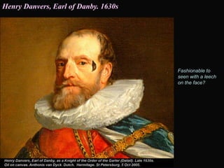 Fashionable to
seen with a leech
on the face?
Henry Danvers, Earl of Danby. 1630s
 