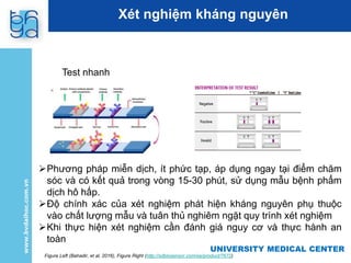 UNIVERSITY MEDICAL CENTER
UNIVERSITY MEDICAL CENTER
Phương pháp miễn dịch, ít phức tạp, áp dụng ngay tại điểm chăm
sóc và có kết quả trong vòng 15-30 phút, sử dụng mẫu bệnh phẩm
dịch hô hấp.
Độ chính xác của xét nghiệm phát hiện kháng nguyên phụ thuộc
vào chất lượng mẫu và tuân thủ nghiêm ngặt quy trình xét nghiệm
Khi thực hiện xét nghiệm cần đánh giá nguy cơ và thực hành an
toàn
Figure Left (Bahadir, et al, 2016), Figure Right (http://sdbiosensor.com/xe/product/7672)
Xét nghiệm kháng nguyên
Test nhanh
 