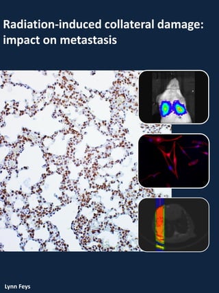 Radiation-induced collateral damage:
impact on metastasis
Lynn Feys
 