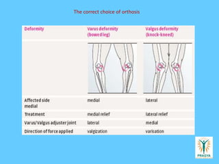 The correct choice of orthosis
 