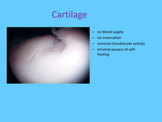 Cartilage
– no blood supply
– no innervation
– minimal chondrocyte activity
– minimal powers of self-
healing
 
