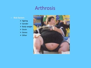 Arthrosis
– Risk factors
 Ageing
 Gender
 Body weight
 Strain
 Genes
 Other
 