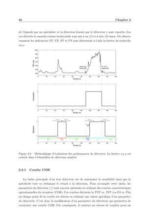 42 Chapitre 2
de l’épisode par un spécialiste et la détection fournie par le détecteur y sont reportés. Les
cas détectés et annotés comme bradycardie sont mis à un (1) et à zéro (0) sinon. On observe
comment les indicateurs VP, VN, FP et FN sont déterminés à l’aide la fenêtre de recherche
wV P .
0 20 40 60 80 100 120 140 160 180
400
500
600
700
800
900
1000
RR(ms)
Temps (s)
Début de la
bradycardie
Fin de la
bradycardie
0 20 40 60 80 100 120 140 160 180
Annotation
Temps (s)
0
1
0 20 40 60 80 100 120 140 160 180
Détection
Temps (s)
0
1
FP TPTN FNTN TN
TRD
. . .
Figure 2.8 – Méthodologie d’évaluation des performances de détection. La fenêtre wV P est
centrée dans l’échantillon de détection analysé.
2.3.1 Courbe COR
La tâche principale d’un bon détecteur est de maximiser la sensibilité ainsi que la
spéciﬁcité tout en réduisant le retard à la détection. Pour accomplir cette tâche, les
paramètres du détecteur (γ) sont souvent optimisés en utilisant des courbes caractéristiques
opérationnelles du récepteur (COR). Ces courbes décrivent la TVP vs. TFP (ou Pd vs. Pfa)
où chaque point de la courbe est obtenu en utilisant une valeur spéciﬁque d’un paramètre
du détecteur. C’est donc la modiﬁcation d’un paramètre du détecteur qui permettra de
construire une courbe COR. Par conséquent, il existera un réseau de courbes pour un
 