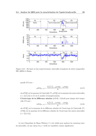 3.5. Analyse du QRS pour la caractérisation de l’apnée-bradycardie 69
0 200 400 600 800 1000
400
600
800
1000
1200
1400
0 200 400 600 800 1000
40
60
80
100
120
140
0 200 400 600 800 1000
0.7
0.8
0.9
1
1.1
RR(ms)QRSd(ms)Ramp
Échantillons
Échantillons
Échantillons
T1 T2 T3 T4
T1 T2 T3 T4
T1 T2 T3 T4
Repos Avant bradycardie
Bradycardie
Après bradycardie
Figure 3.10 – De haut en bas respectivement, intervalles d’analyses de séries temporelles
RR, QRSd et Ramp.
porelle TS avec :
µDAT1−Ti =
X=Xi
x1=xi=1 |µTSx1
T1 − µTSxi
Ti|
X
(3.17)
où µTSx1
T1 est la moyenne de l’intervalle T1, µTSxi
Ti est la moyenne des autres intervalles
(i = {2, 3, 4}) et X est le nombre d’enregistrements.
– L’écart-type de la diﬀérence absolue (σDA) : Calculé pour chaque série tempo-
relle TS avec :
σDAT1−Ti =
X=Xi
x1=xi=1 |σTSx1
T1 − σTSxi
Ti|
X
(3.18)
où σTSx1
T1 est la moyenne de la diﬀérence absolue de l’écart-type de l’intervalle T1,
σTSxi
Ti est la moyenne de la diﬀérence absolue de l’écart-type des autres intervalles
(i = {2, 3, 4}).
Le test d’hypothèse de Mann–Whitney U a été utilisé pour analyser les variations entre
les intervalles, où une valeur de p < 0, 05 est considérée comme signiﬁcative.
 