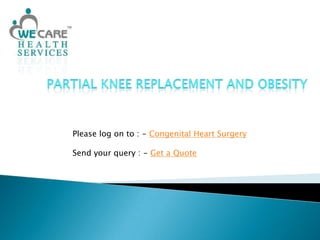 Partial Knee Replacement and Obesity Please log on to : - Congenital Heart Surgery Send your query : - Get a Quote 