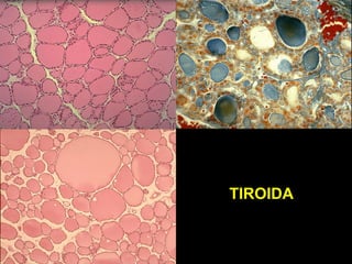 Tiroidna Sistemul endocrin | PPT