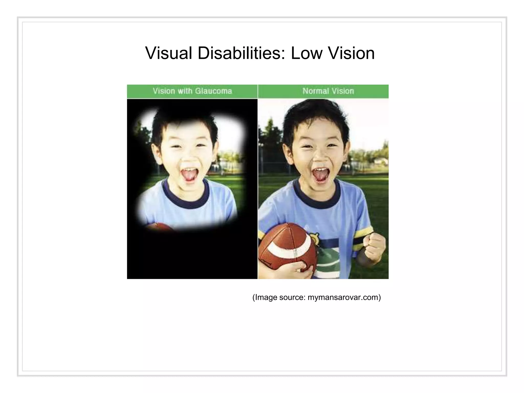(Image source: mymansarovar.com)
Visual Disabilities: Low Vision
 