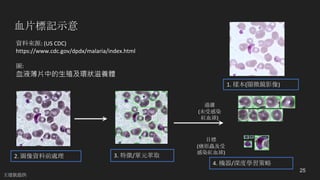 血片標記示意
25
1.	樣本(顯微鏡影像)
2.	圖像資料前處理 3.	特徵/單元萃取
4.	機器/深度學習策略
過濾
(未受感染
紅血球)
目標
(瘧原蟲及受
感染紅血球)
資料來源: (US	CDC)
https://www.cdc.gov/dpdx/malaria/index.html
圖:
血液薄片中的生殖及環狀滋養體
王建凱提供
 