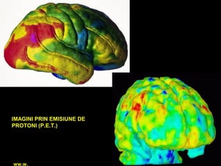 ww.w.
IMAGINI PRIN EMISIUNE DE
PROTONI (P.E.T.)
 