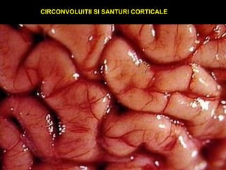 CIRCONVOLUITII SI SANTURI CORTICALE
 