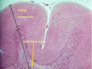CORTEX
Subst.cenusie
SUBSTANTA ALBA
 