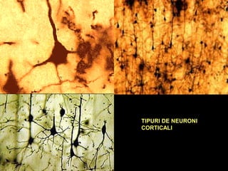 TIPURI DE NEURONI
CORTICALI
 
