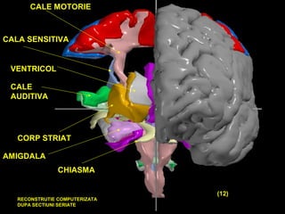 CORP STRIAT
VENTRICOL
CHIASMA
AMIGDALA
CALE
AUDITIVA
CALE MOTORIE
CALA SENSITIVA
RECONSTRUTIE COMPUTERIZATA
DUPA SECTIUNI SERIATE
(12)
 