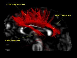 COROANA RADIATA
FASC.CINGULAR
FASC.LONG.INF
 