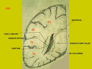 RADIATII CORP CALOS
FASC.LONG.INF.
RADIATII OPTICE
TAPETUM
SC.CALCARINA
VENTRICOL
P1
P2
T2
T3
(20)
 