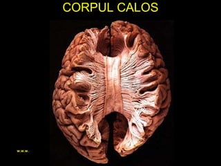 CORPUL CALOS
w.w.w.
 
