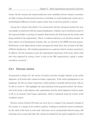 108 Chapter 5. Brain segmentation and motion correction
tissues. On the contrary, the manual masks have more variability between subjects, sometimes
not fully covering all intracranial structures or including too much background, mostly due to
methodological diﬀerences between experts rather than to the fetus position or motion.
Among the 5 subjects that failed to be reconstructed with the automated method but were
successfully reconstructed with the manual initialisation, 3 failures can be attributed to part of
the maternal bladder or portions of amniotic ﬂuid between the fetal head and the uterine wall
being included in the segmentation. This is a weakness inherent to our detection method. As
these regions are of homogeneous intensity, they are selected in the MSER detection process.
Furthermore, as the ellipses ﬁtted to them encompass the whole brain, they are kept in the Bag-
of-Words classiﬁcation. The resulting segmentation is a mask too wide for motion correction to
be eﬃcient. For the remaining 2 cases, the segmentation missed part of the brain, which could
have been improved by setting a lower λ value in the CRF segmentations, namely a weaker
smoothness constraint.
5.6.1 Extreme motion
As presented in Figure 5.9, the success of motion correction strongly depends on the initial
alignment of all stacks after volume-to-volume registration. If the initial misalignment is too
signiﬁcant, the slice-to-volume registration, which performs a spatially limited search, will not
be able to correct it. This highlights the main limitation of the proposed method: the orienta-
tion of the brain is still unknown after segmentation and the initial alignment between stacks
is left to an intensity based image registration, which is initialised using the scanner world
coordinate system.
Extreme motion between 3D stacks can occur due to a change of the parameter settings of
the scanner or a change of the mother’s position, resulting in incoherent scanner coordinates
for the center of the brain in each stack. Such cases can be automatically detected using a 3D
clustering such as mean shift [26] with a kernel size deﬁned by the typical amplitude of a fetal
 